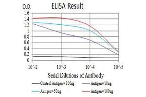 Black line: Control Antigen (100 ng),Purple line: Antigen (10 ng), Blue line: Antigen (50 ng), Red line:Antigen (100 ng)