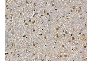 eEF2K Mouse Monoclonal Antibody at 1/100 staining rat brain tissue by IHC-P. (EEF2K anticorps  (Internal Region))