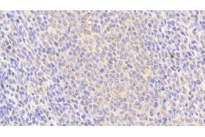 Detection of HPSE in Human Spleen Tissue using Polyclonal Antibody to Heparanase (HPSE)