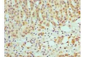 Immunohistochemistry of paraffin-embedded human adrenal gland tissue using ABIN7145593 at dilution of 1:100 (SULT2A1 anticorps  (AA 1-145))
