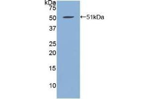 Western blot analysis of recombinant Human FBN1. (Fibrillin 1 anticorps  (AA 723-902))