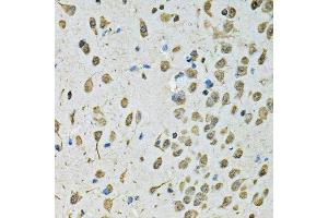 Immunohistochemistry of paraffin-embedded mouse brain using PSMB1 antibody.