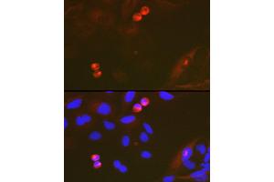 Immunofluorescence analysis of U-2 OS cells using T Rabbit mAb (ABIN7270916) at dilution of 1:100 (40x lens).