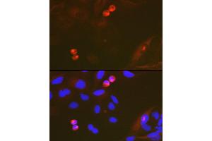 Immunofluorescence analysis of U-2 OS cells using T Rabbit mAb (ABIN7270916) at dilution of 1:100 (40x lens). (TACC3 anticorps)
