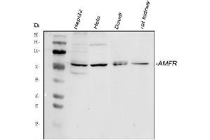 Western blot analysis of AMFR using anti-AMFR antibody (ABIN4886455). (AMFR anticorps  (AA 553-643))