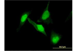 Immunofluorescence of monoclonal antibody to DPYSL2 on HeLa cell. (DPYSL2 anticorps  (AA 470-571))