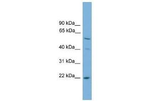 Western Blot showing UBE2T antibody used at a concentration of 1-2 ug/ml to detect its target protein. (Ube2t anticorps  (N-Term))