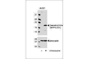 Western blot analysis of lysates from A431 cell line, untreated or treated with chloroquine, 100 ng/mL, using Cleaved-G8a (M1LC3A) Antibody 1805a (upper) or Beta-actin (lower).