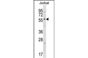 Western blot analysis in Jurkat cell line lysates (35ug/lane). (Glypican 3 anticorps  (C-Term))