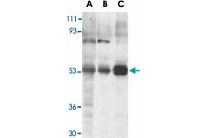Western blot analysis of TRIM5 expression in human stomach (A), thymus (B), and uterus (C) cell lysate with TRIM5 alpha polyclonal antibody  at 2 ug /mL . (TRIM5 anticorps  (Internal Region))