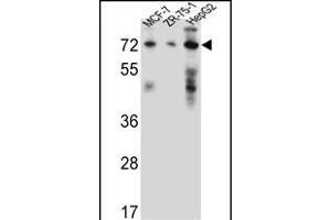 HSD17B4 Antibody (Center) (ABIN656447 and ABIN2845732) western blot analysis in MCF-7,ZR-75-1,HepG2 cell line lysates (35 μg/lane). (HSD17B4 anticorps  (AA 341-370))