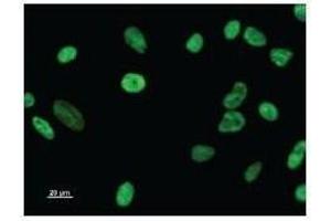 Immunostaining analysis in HeLa cells.