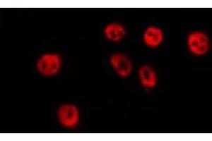 ABIN6276651 staining Hela by IF/ICC. (MITF anticorps  (Internal Region))