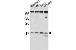 TCRB Antibody (Center) western blot analysis in MDA-MB231, 293, Ramos, NCI-H460 cell line lysates (35 µg/lane).
