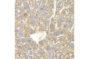 Immunohistochemistry of paraffin-embedded mouse liver using CYP2C18 antibody. (CYP2C18 anticorps  (AA 231-490))