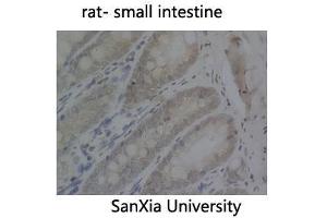 Immunohistochemistry (IHC) analysis: Please contact us for more details. (PCNA anticorps)