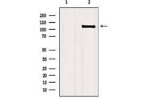 Western blot analysis of extracts from HUVEC, using FGFR1 Antibody. (FGFR1 anticorps  (C-Term))