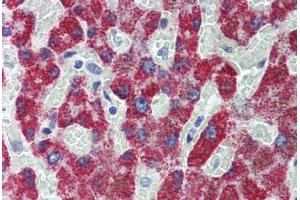 anti-Acyl-CoA Dehydrogenase, C-2 To C-3 Short Chain (Acads) (AA 1-104) antibody