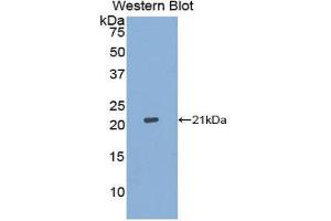 Western Blotting (WB) image for anti-Aconitase 1 (ACO1) (AA 26-189) antibody (ABIN1176781) (Aconitase 1 anticorps  (AA 26-189))