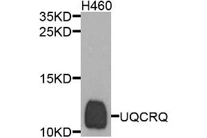 Western blot analysis of extracts of H460 cells, using UQCRQ antibody. (UQCRQ anticorps)