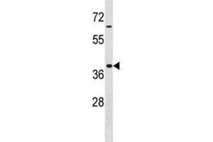 Hoxa9 antibody western blot analysis in MDA-MB453 lysate. (HOXA9 anticorps  (AA 160-189))