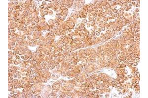 IHC-P Image DR3 antibody detects TNFRSF25 protein at cytosol on AGS xenograft by immunohistochemical analysis. (DR3/LARD anticorps  (Center))