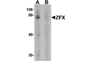 Western blot analysis of ZFX human small intestine tissue lysate with ZFX Antibody  at 1 ug/ml in (A) the absence and (B) the presence of blocking peptide. (ZFX anticorps  (C-Term))