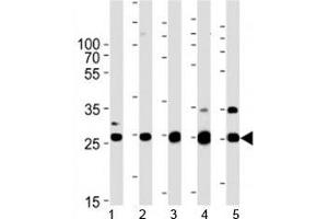 Sdhb antibody western blot analysis in human 1) HeLa, 2) HL-60, 3) mouse heart, 4) rat heart, and 5) zebrafish heart tissue lysate.