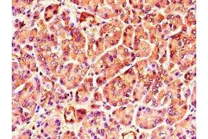 Immunohistochemistry of paraffin-embedded human pancreatic tissue using ABIN7173407 at dilution of 1:100 (TNRC6C anticorps  (AA 157-421))
