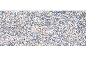 Immunohistochemistry of paraffin-embedded Human tonsil tissue using NEGR1 Polyclonal Antibody at dilution of 1:90(x200) (NEGR1 anticorps)