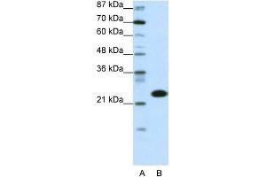 WB Suggested Anti-TAF11 Antibody Titration:  0. (TAF11 anticorps  (N-Term))