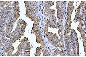 IHC analysis of YWHAE using anti-YWHAE antibody (ABIN7599165). (YWHAE anticorps  (AA 1-255))