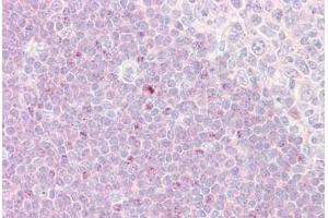 Anti-RPS6KA1 / RSK1 antibody IHC staining of human tonsil.