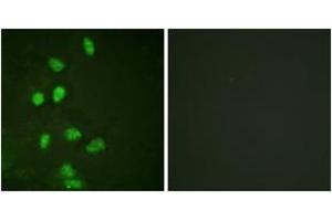 Immunofluorescence analysis of HeLa cells, using CHOP (Ab-30) Antibody. (DDIT3 anticorps  (AA 15-64))