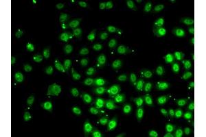 Immunofluorescence analysis of HeLa cell using GABPB1 antibody. (GABPB1 anticorps)