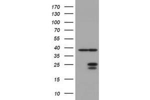 Image no. 1 for anti-Ubiquitin-Conjugating Enzyme E2E 3 (UBE2E3) antibody (ABIN1501623) (UBE2E3 anticorps)