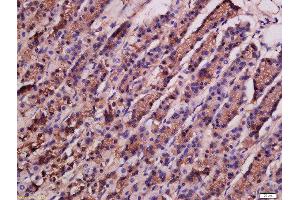 Formalin-fixed and paraffin embedded rat stomach labeled with Rabbit Anti-ATG9A Polyclonal Antibody, Unconjugated  at 1:200 followed by conjugation to the secondary antibody and DAB staining (ATG9A anticorps  (AA 301-400))