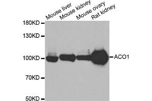 Western blot analysis of extracts of various cell lines, using ACO1 antibody (ABIN5973578) at 1/500 dilution. (Aconitase 1 anticorps)