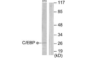 Western blot analysis of extracts from NIH-3T3 cells, using C/EBP epsilon antibody. (CEBPE anticorps  (C-Term))