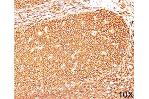 IHC testing of human tonsil (10X) stained with CD45RB antibody (PD7/26).