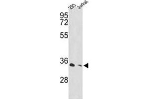 Western Blotting (WB) image for anti-Proteasome (Prosome, Macropain) 26S Subunit, Non-ATPase, 11 (PSMD11) antibody (ABIN3001640) (PSMD11 anticorps)