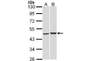 WB Image Sample (30 ug of whole cell lysate) A: A431 , B: Hep G2 , 10% SDS PAGE antibody diluted at 1:1000