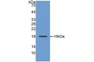 Detection of Recombinant GAPDH, Human using Monoclonal Antibody to Glyceraldehyde-3-Phosphate Dehydrogenase (GAPDH) (GAPDH anticorps  (AA 2-148))