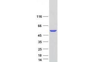 Validation with Western Blot