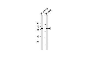 All lanes : Anti-MKS1 Antibody (N-Term) at 1:2000 dilution Lane 1: Human kidney lysate Lane 2: Human lung lysate Lysates/proteins at 20 μg per lane.