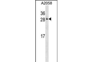 RAB28 Antibody (Center) (ABIN1537780 and ABIN2848638) western blot analysis in  cell line lysates (35 μg/lane). (RAB28 anticorps  (AA 119-147))