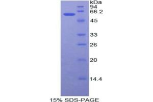SDS-PAGE analysis of Human ADA Protein.