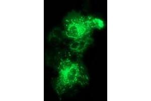 Anti-MMAB mouse monoclonal antibody (ABIN2454036) immunofluorescent staining of COS7 cells transiently transfected by pCMV6-ENTRY MMAB (RC204290). (MMAB anticorps)