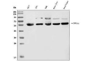 Western blot analysis of CYP51A1/CYP51 using anti-CYP51A1/CYP51 antibody (ABIN7600046).