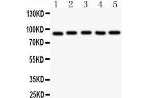 Western Blotting (WB) image for anti-Aryl Hydrocarbon Receptor Nuclear Translocator (ARNT) (AA 416-789) antibody (ABIN3043528) (ARNT anticorps  (AA 416-789))